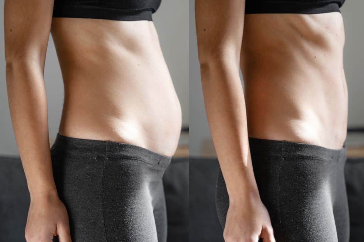 Post-Pregnancy: What Happens to Your Abdominal Muscles After Birth Norwood Green